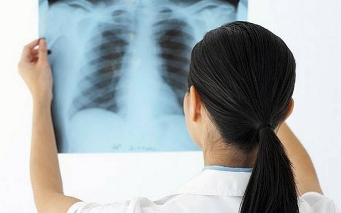 Ở Việt Nam, tình hình bệnh lao phổi thời kỳ cuối như thế nào?